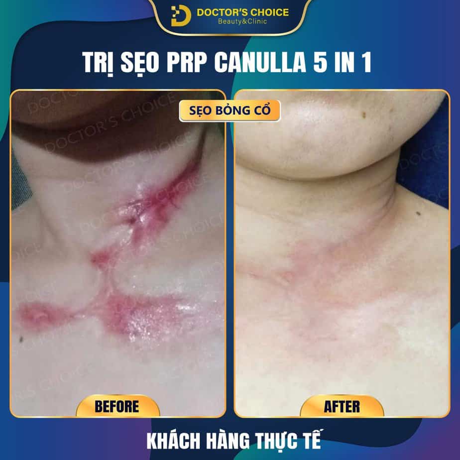 Review Dịch Vụ Tại Dr.Choice Clinic Có Tốt Không? 376