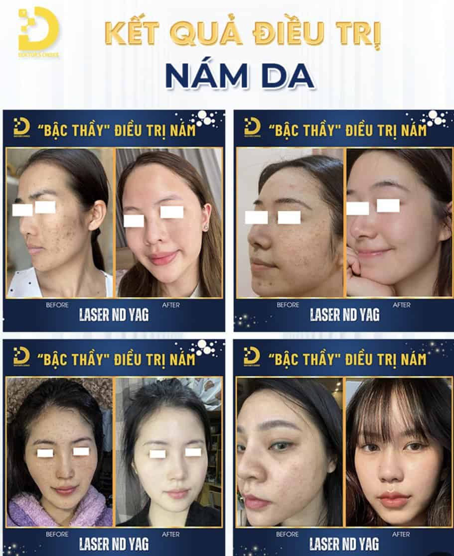 Review Dịch Vụ Tại Dr.Choice Clinic Có Tốt Không? 378